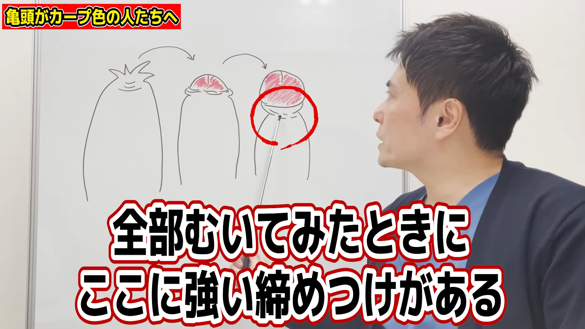 亀頭を触ると痛い原因は？赤み・ヒリヒリを放置するリスクと治し方