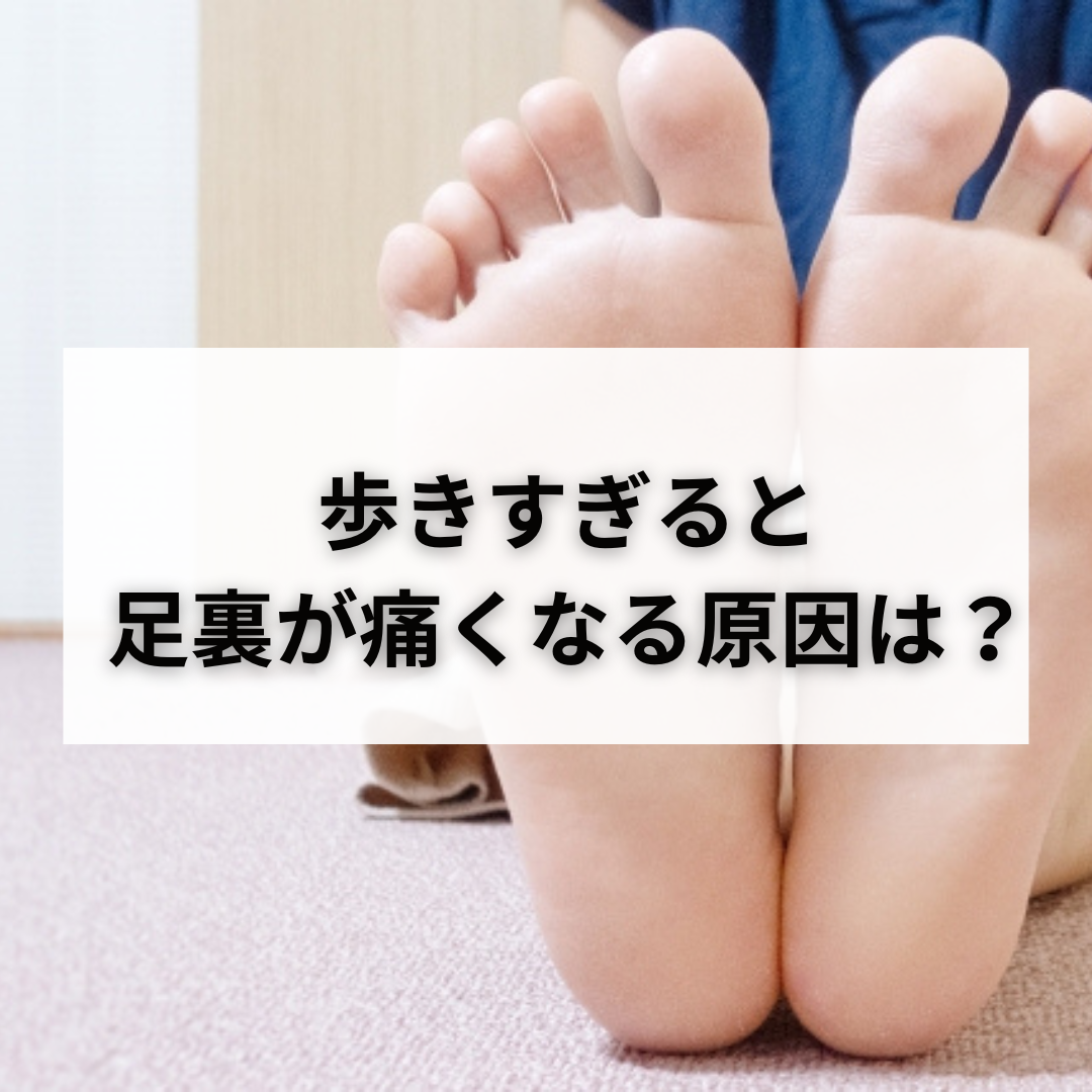 歩きすぎて足の裏が痛い原因と治し方！土踏まず・かかと激痛の対処法