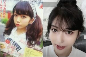 【動画まとめ】 R ちゃん 整形 前 公式インスタ・X最新情報 #840