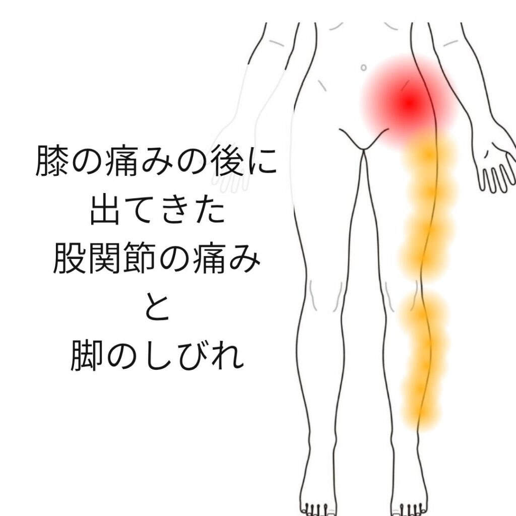 股関節と膝が同時に痛む原因とは？放置厳禁の連動痛と最新対処法