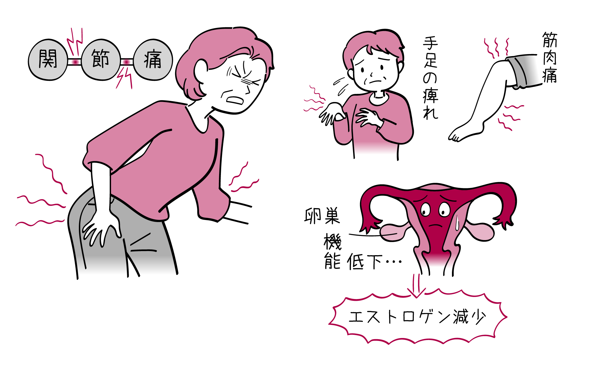 更年期の関節痛を放置するな！手指のこわばり・リウマチ判別の真相
