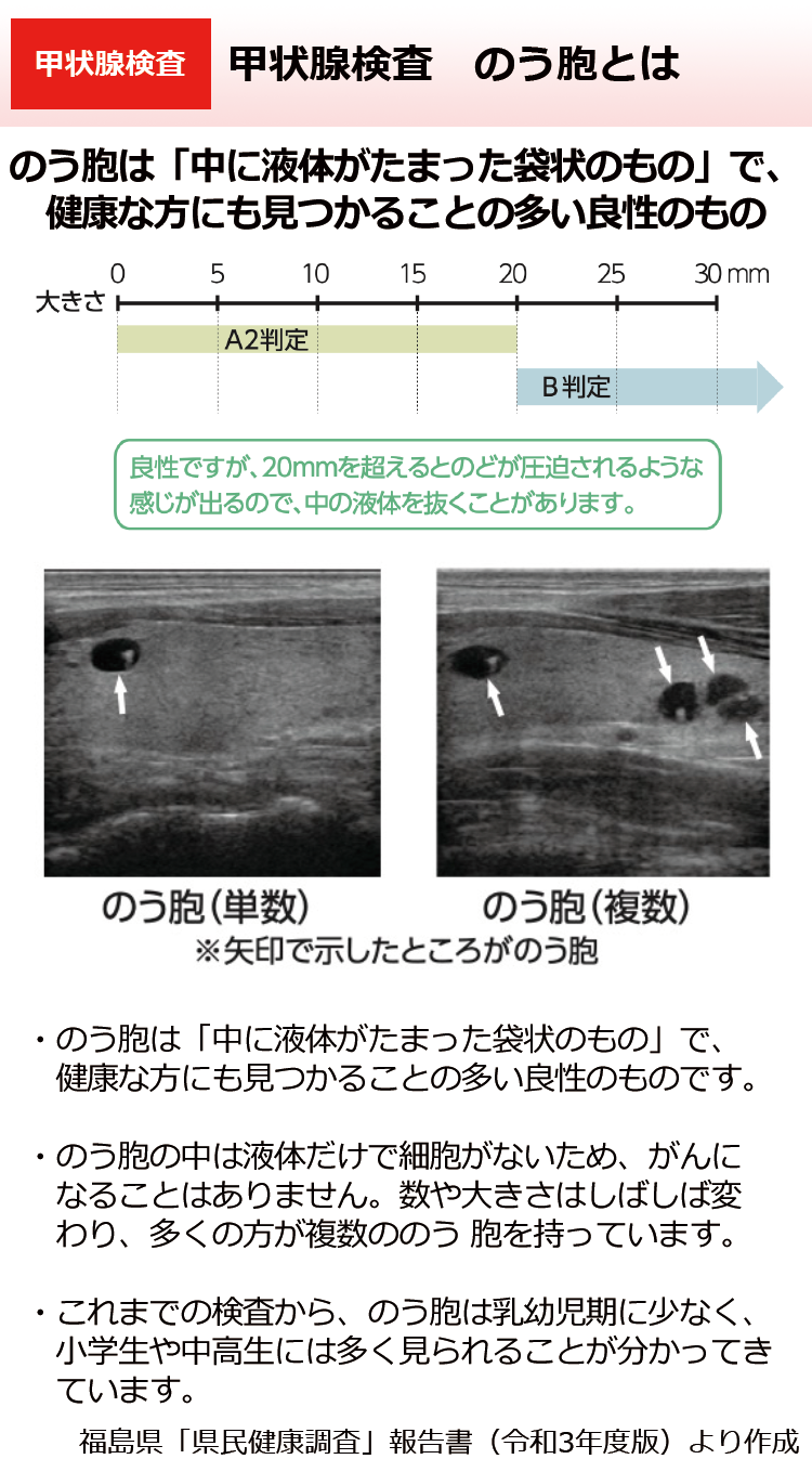 甲状腺嚢胞とは？健診で要観察と言われたら知るべき真実と対処法