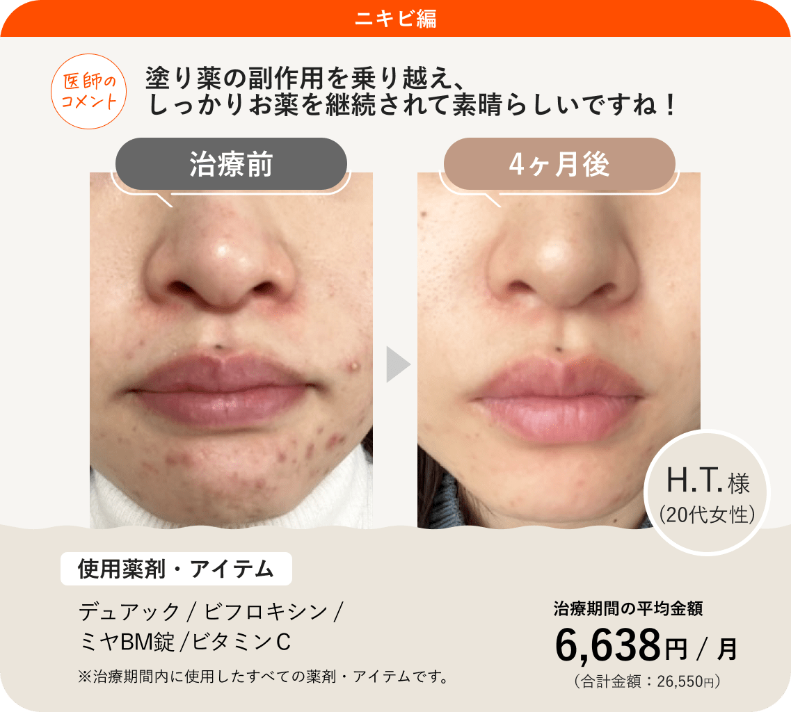 ミヤBmの効果と真実｜ビオフェルミンとの違いや肌荒れ改善を徹底検証