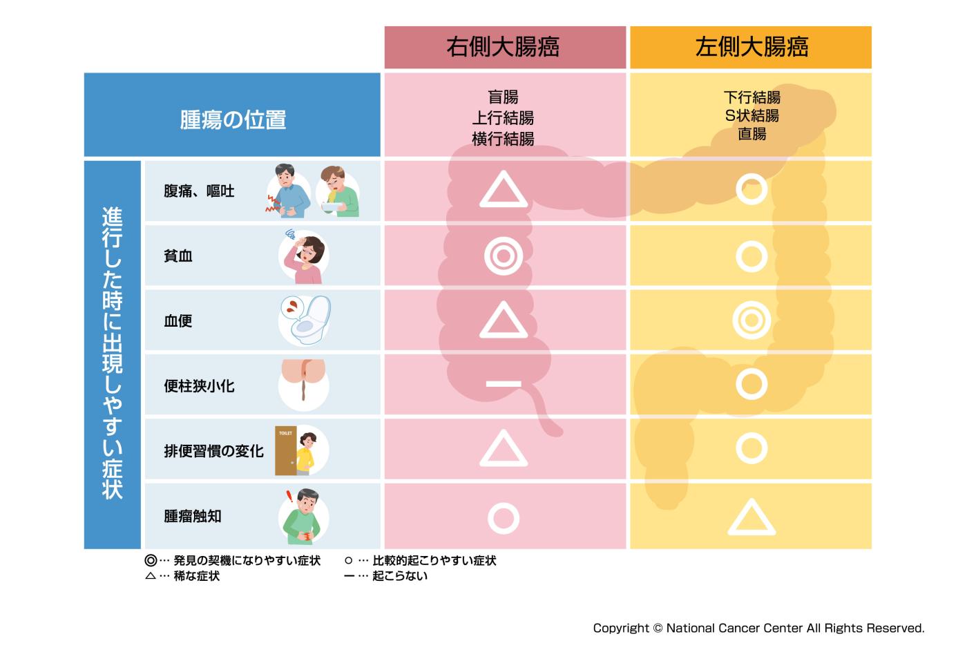 大腸がん初期症状の真実｜便の細さや痔との違い・検査の全貌