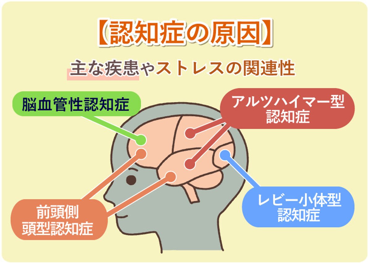 認知症の原因を徹底解剖｜加齢だけじゃない発症メカニズムと2026年最新予防の糸口