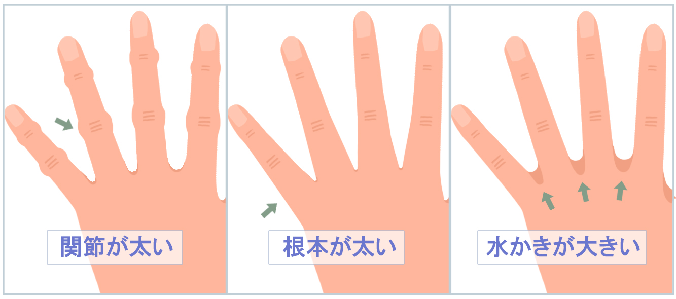婚約指輪のサイズ選びで失敗する人が続出している理由とは？指がむくむ時間帯や正しい測り方、知らないと後悔する決定的な注意点を2026年最新情報で詳しく解説します。
