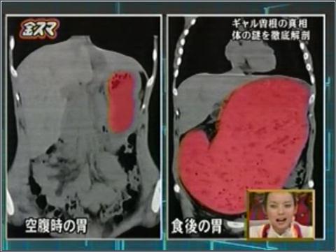 【動画まとめ】 ギャル 曽根 レントゲン 衝撃の最新ニュース #875