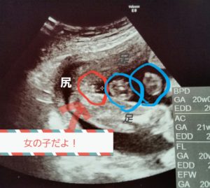 【話題】 妊娠 性別 女の子 特徴 歴代彼氏・彼女まとめ #855