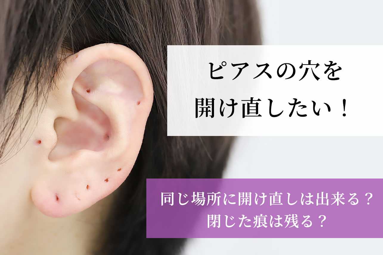 ピアスの開け直しはいつから？同じ場所のリスクやしこり対処法を解説