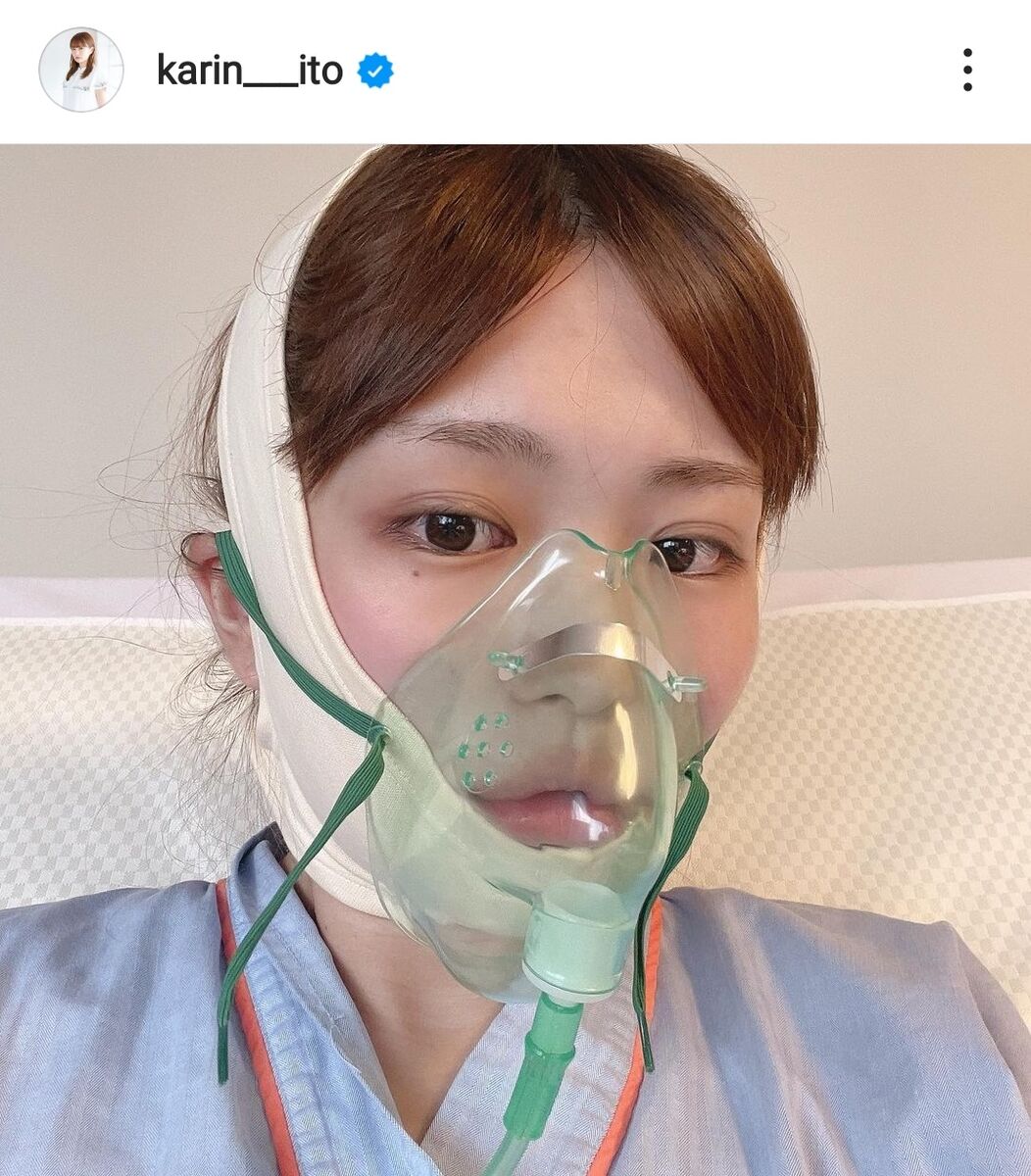 顎変形症の手術を公表した芸能人一覧！顔の変化と過酷な経過の全真相