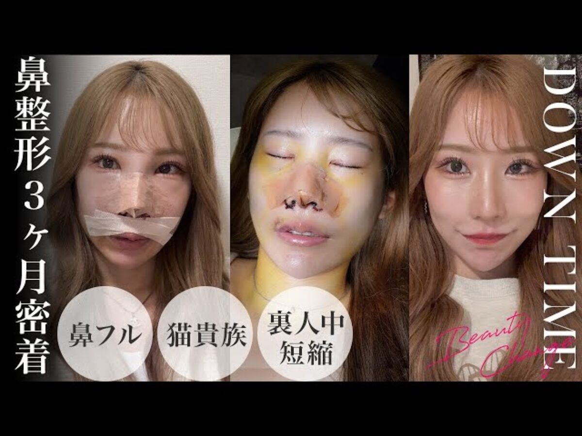 整形ダウンタイム完全攻略｜部位別の目安・腫れピークと最短回復法