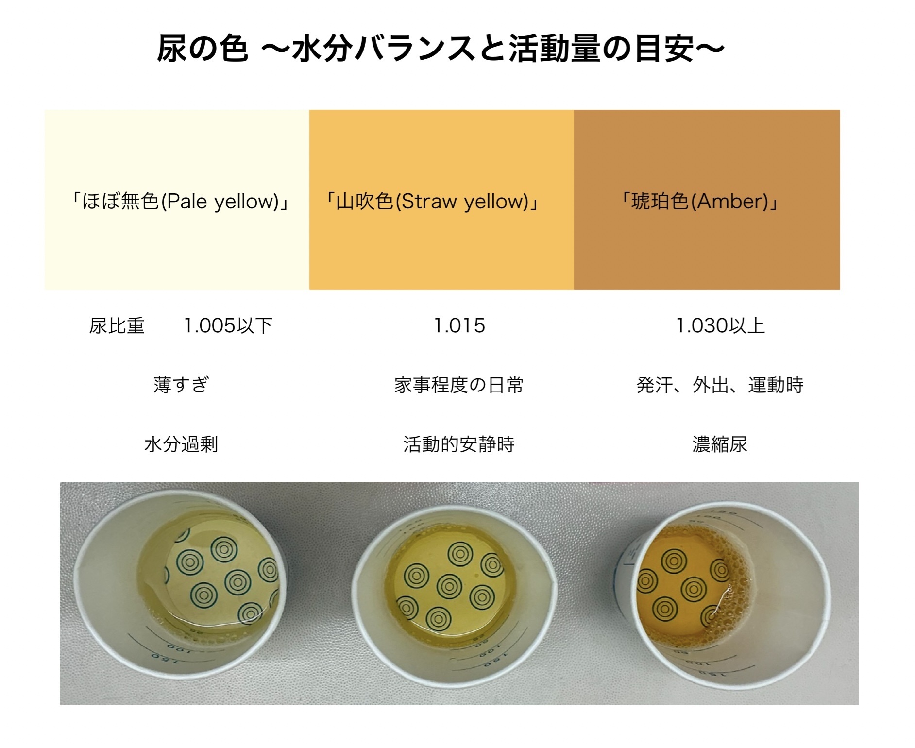 尿の色写真で危険度を判定｜赤・茶・濁り・泡立ちの原因と受診目安