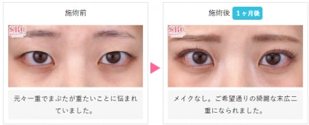 【2026最新】 二 重 が 一重 に なっ た 私服＆私生活最新ショット #778