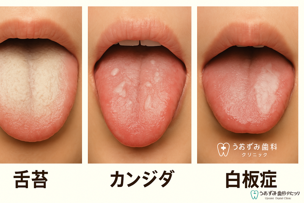 朝磨いても舌がすぐ白くなる謎！専門医が鳴らす病気の警告と対処法