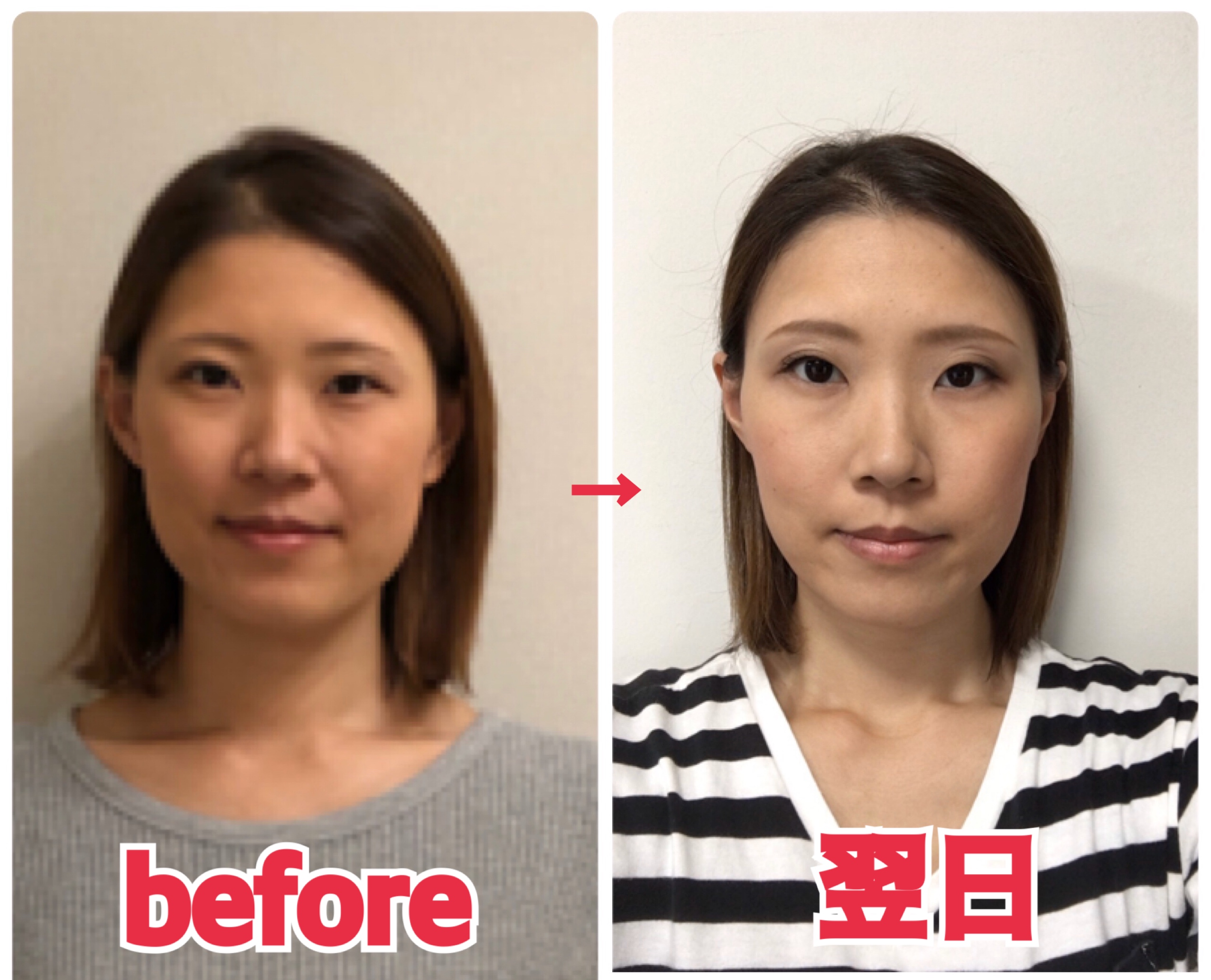 凛とした気品！エラ張り女優の魅力と小顔に見せる最新メイク術