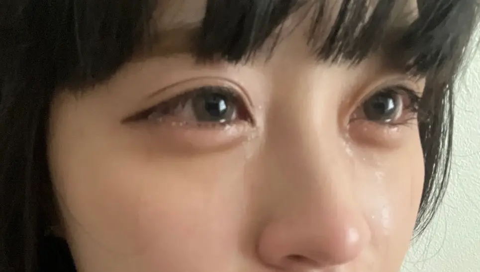 【2026年最新レスキュー】泣いた翌朝の「パンパン瞼」を爆速でリセット！プロが教える即効ケアとNg習慣完全ガイド