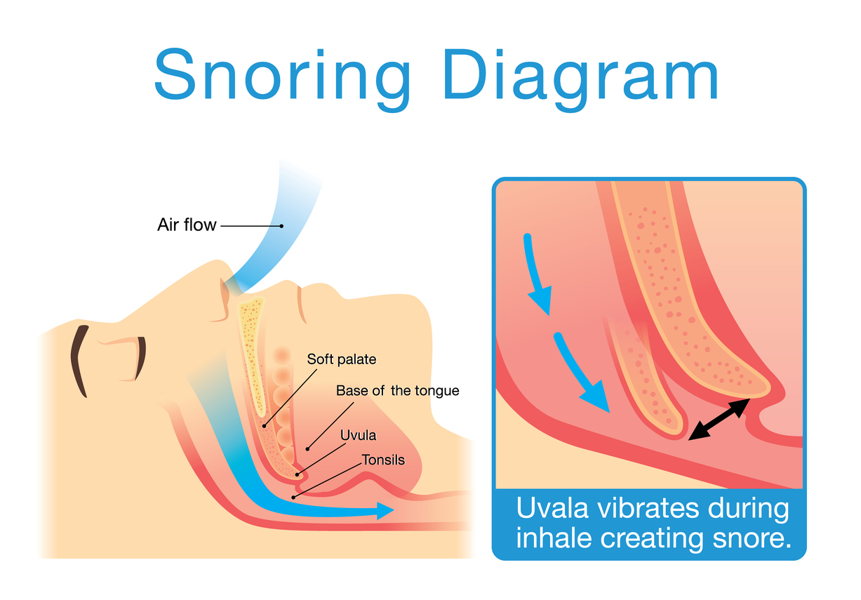 いびきはなぜかくのか？睡眠時無呼吸症候群の危険サインと今日からできる対策