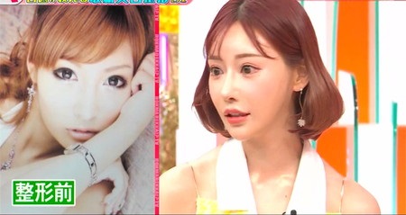 【インスタ画像】 明日 花 キララ 整形 最新写真集＆動画まとめ #758