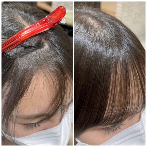 「前髪が割れる」悩みに終止符？2026年、進化する「生え癖矯正」の最前線とサロン業界の地殻変動