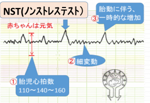 【2026最新】 ノン ストレス と は 話題のSns投稿まとめ 2026 #753