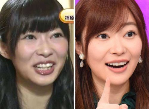 指原莉乃のビジュアル進化論：「顔の変化」をめぐる議論と令和最強プロデューサーの美学【2026最新分析】