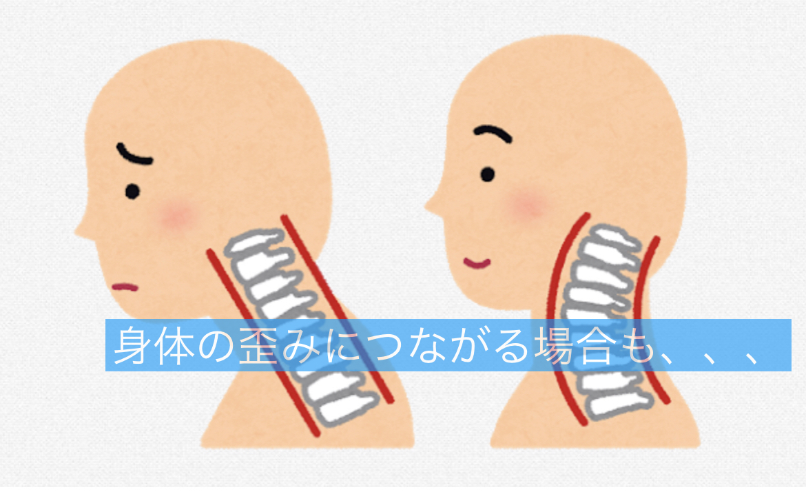 首のパキッ音は脳卒中リスク？最新医学が明かす鳴らし癖の真実