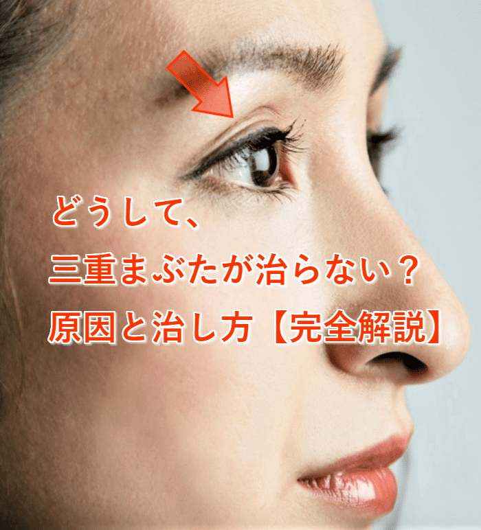 片目だけ三重まぶたが治らない…その裏に潜む意外な原因と2026年最新の対処法を眼科専門医が解説
