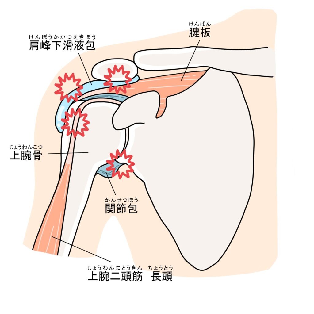 右肩甲骨が痛い原因は内臓かコリか？危険な病気のサインと正しい対処法