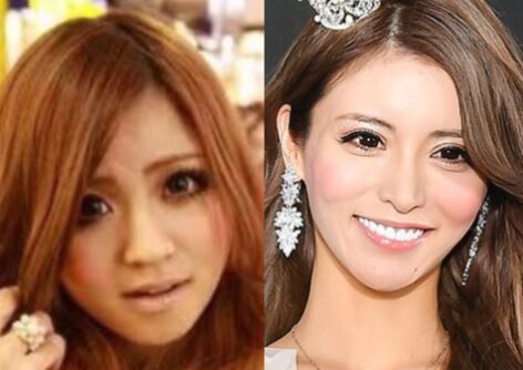 【画像あり】 一条 響 整形 前 話題のSns投稿まとめ 2026 #894