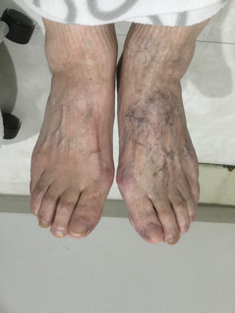 冷えると足が痛い原因は病気？危険な初期症状と正しい治し方を徹底解説