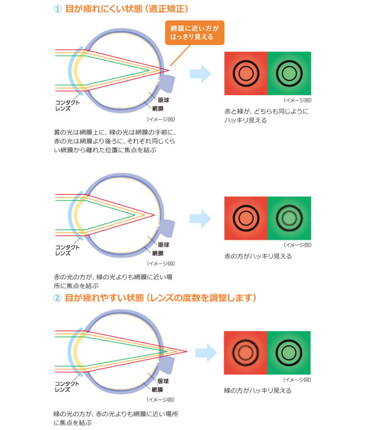 視力検査の赤と緑はどっちが正解？見え方の違いと過矯正の落とし穴