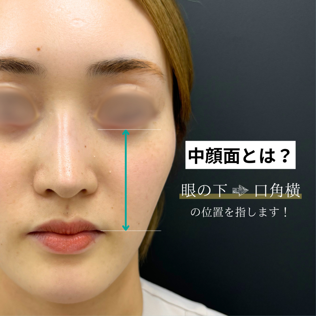 中顔面の長さの平均は何Cm？正しい測り方と整形級の短縮術を徹底解説