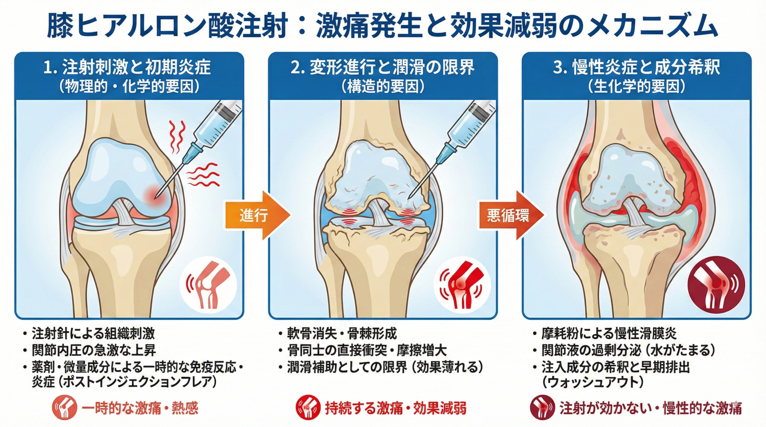 膝のヒアルロン酸注射は痛い？術後のズキズキ原因と対処法を徹底検証