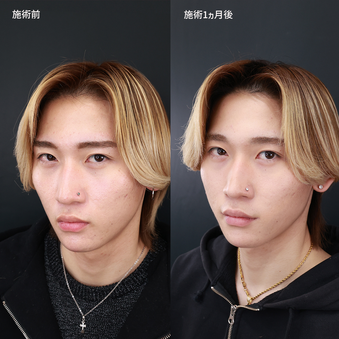 口角が上がってる人はなぜ魅力的？生まれつきの理由と好印象の秘訣