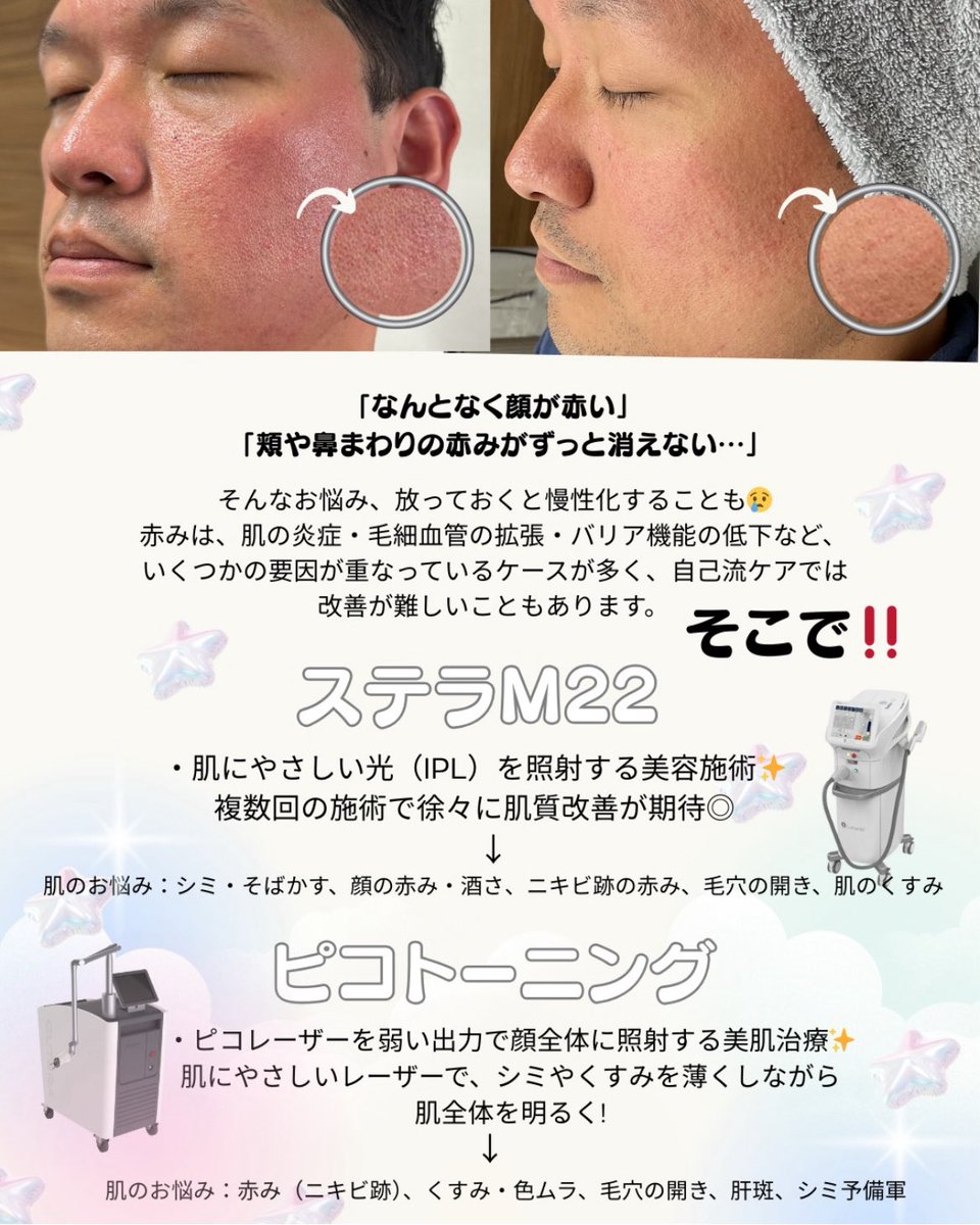 銀座中央クリニックの口コミ評判と料金を徹底調査！失敗の噂の真相