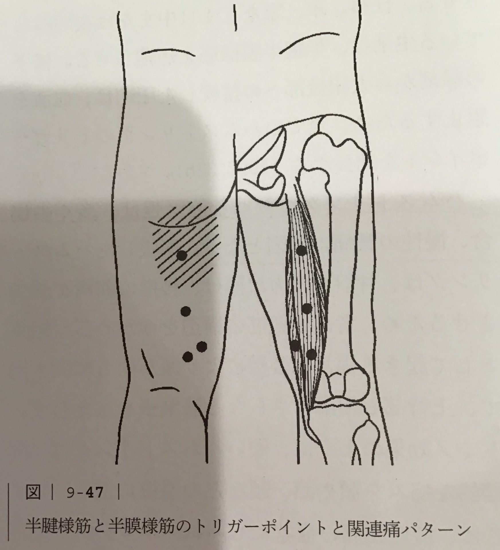 ももの付け根が痛い原因は？放置危険な病気と対処法を徹底解説