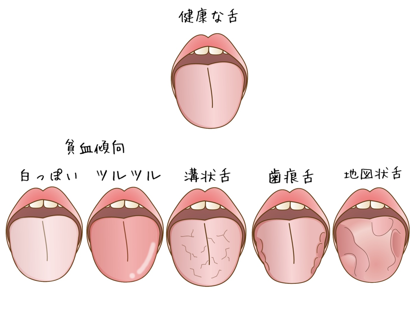 舌の状態でわかる内臓Sos！白・黄・ひび割れの危険信号と見分け方