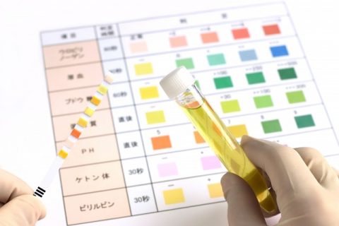 【2026最新】 尿 検査 生理 中 2026年最新メディア #706