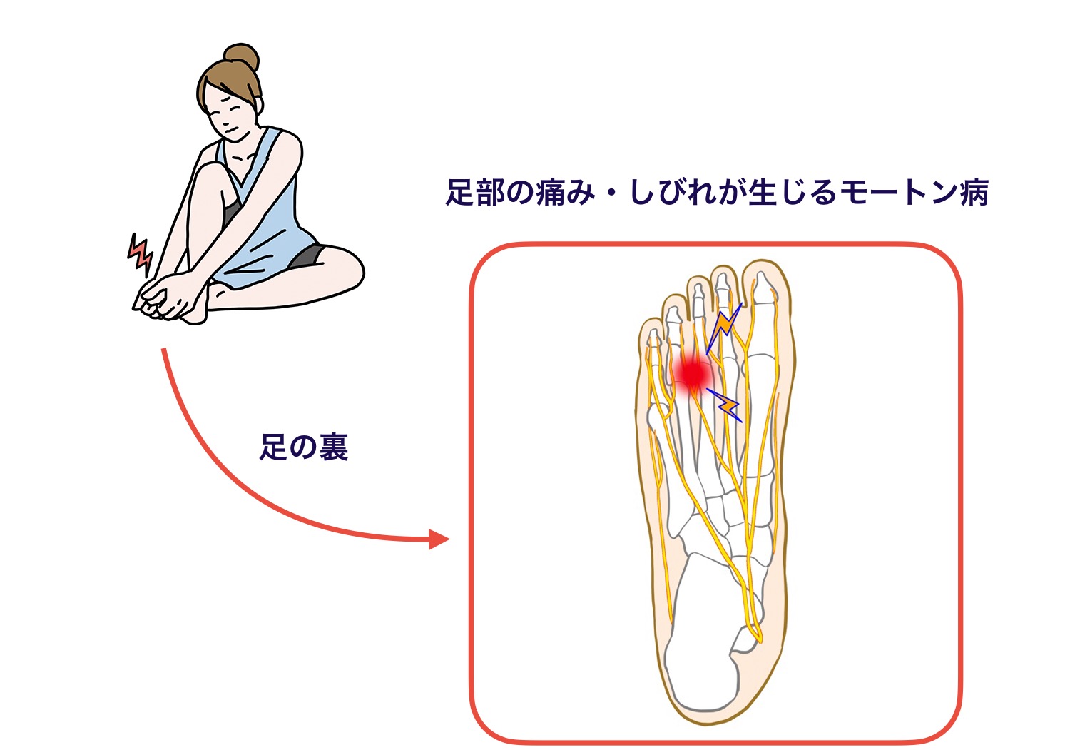 足の指のしびれは危険信号？ピリピリする原因と後悔しない受診先