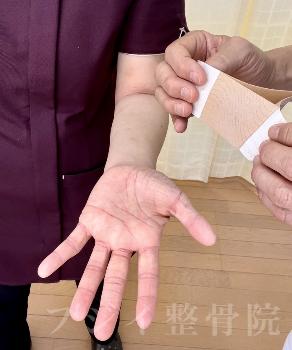 親指と人差し指のしびれは危険？原因の見分け方と受診の目安【2026】