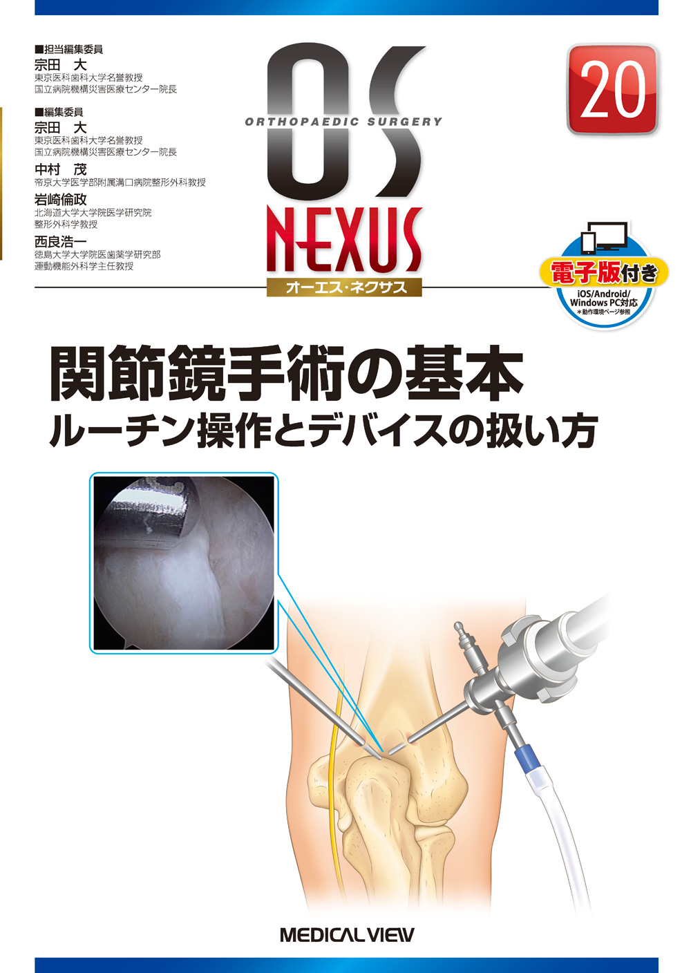 関節鏡手術の真実｜費用・術後の痛み・入院日数と後悔しない全知識