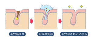 【プロフィール】 洗顔後 毛穴 白いポツポツ 取り方 人気理由と評判まとめ #908
