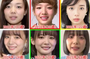 【必見】 岡田 紗 佳 整形 最新ニュース速報 2026 #998