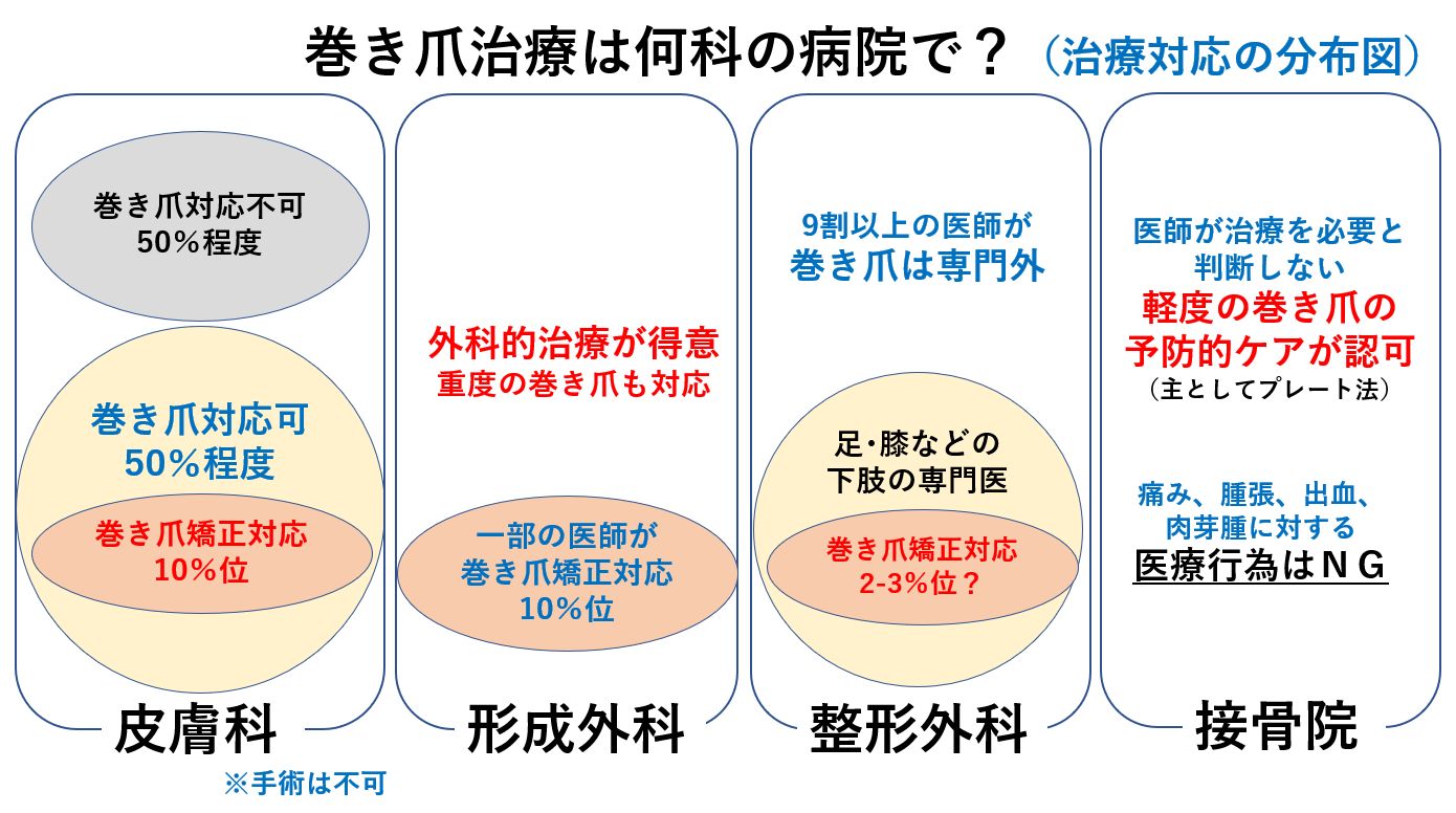 巻き爪は病院の何科へ？皮膚科・形成外科の違いと後悔しない治療法