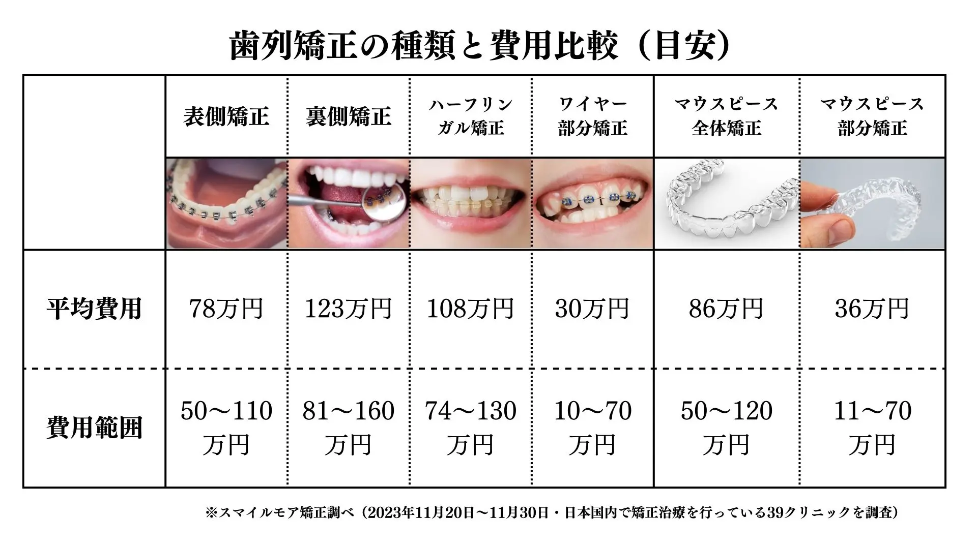 歯列矯正の費用相場を徹底解剖！値段の違いと後悔を防ぐ選び方