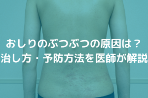 【Wiki風】 おしり の ブツブツ 治す 方法 2026年最新プロフィール #858