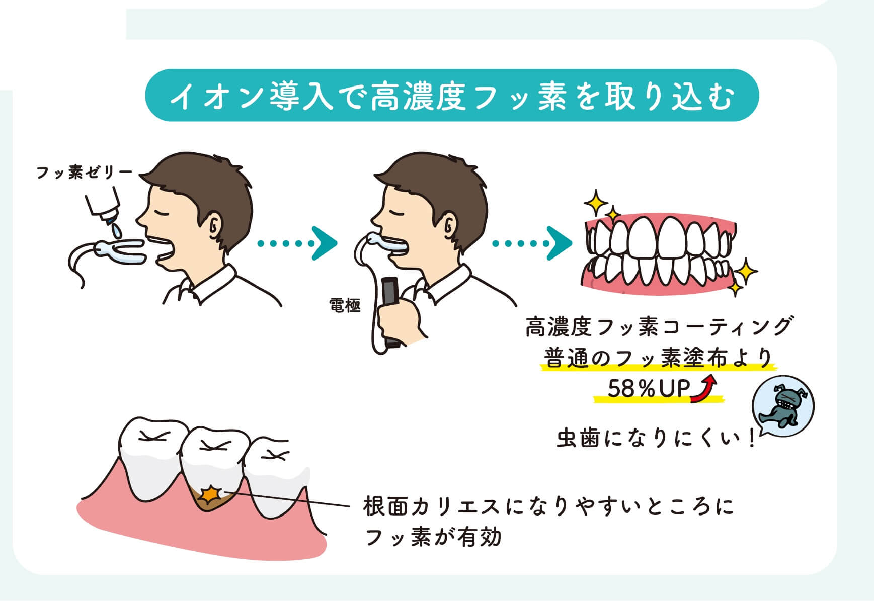 歯医者で起きたフッ酸誤塗布の真相｜フッ素との違いと安全性を徹底検証