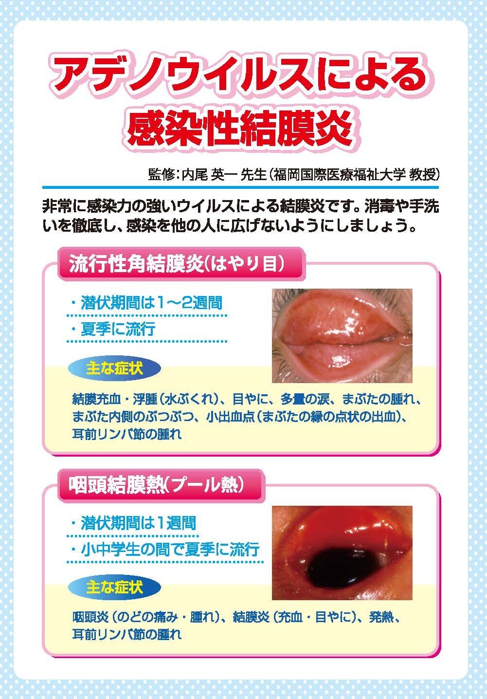 アデノウイルスの充血が治らない理由とは？はやり目の経過と出勤停止基準