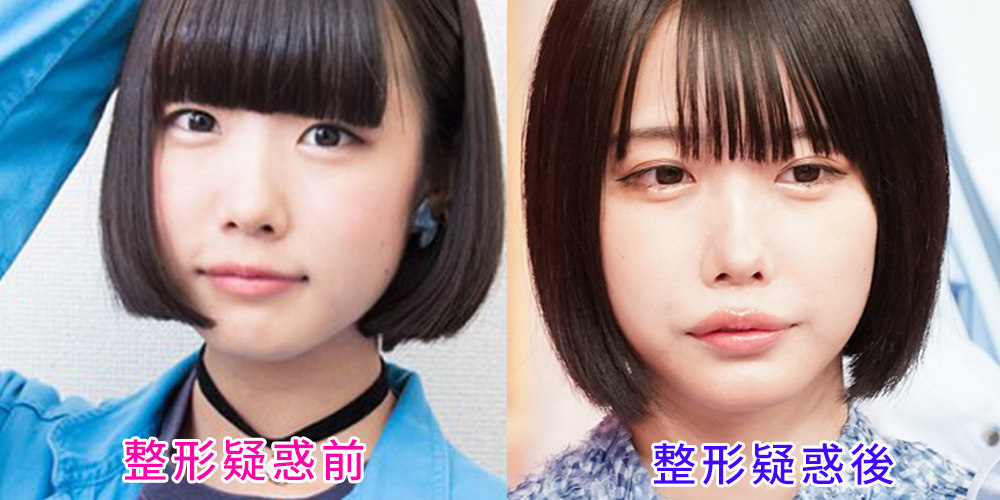 【2026年最新検証】あのちゃんの「顔の変化」をめぐる狂騒曲——噂の真相とデジタル消費社会の歪み