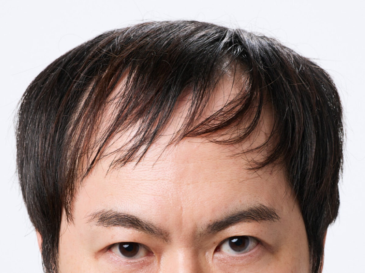 前髪が薄い男の似合う髪型2026！無理に隠さず劇的改善する極意